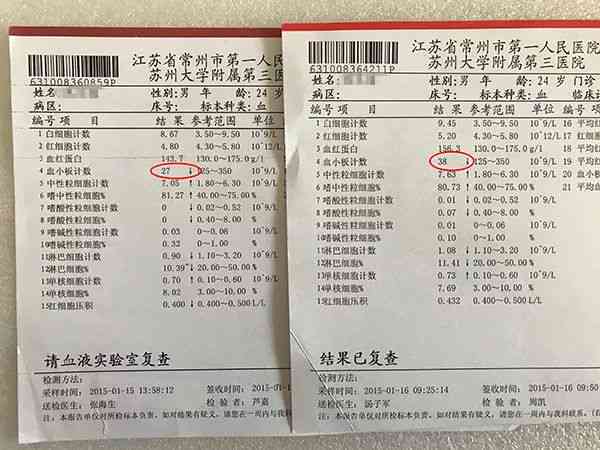 ai血液检查报告多久出来：报告单及结果所需时长解析