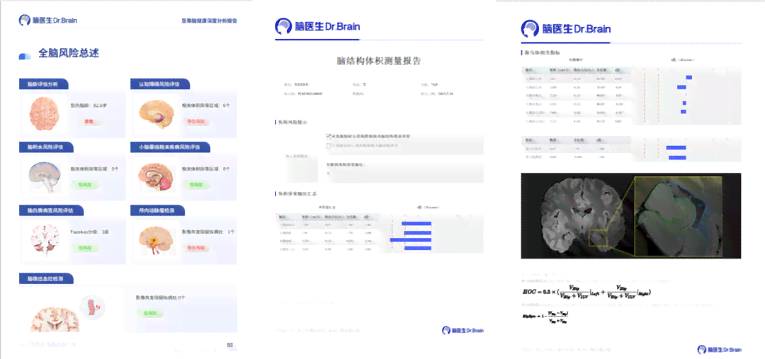 AI辅助核磁共振检测：报告生成速度与常规检查流程全面解析