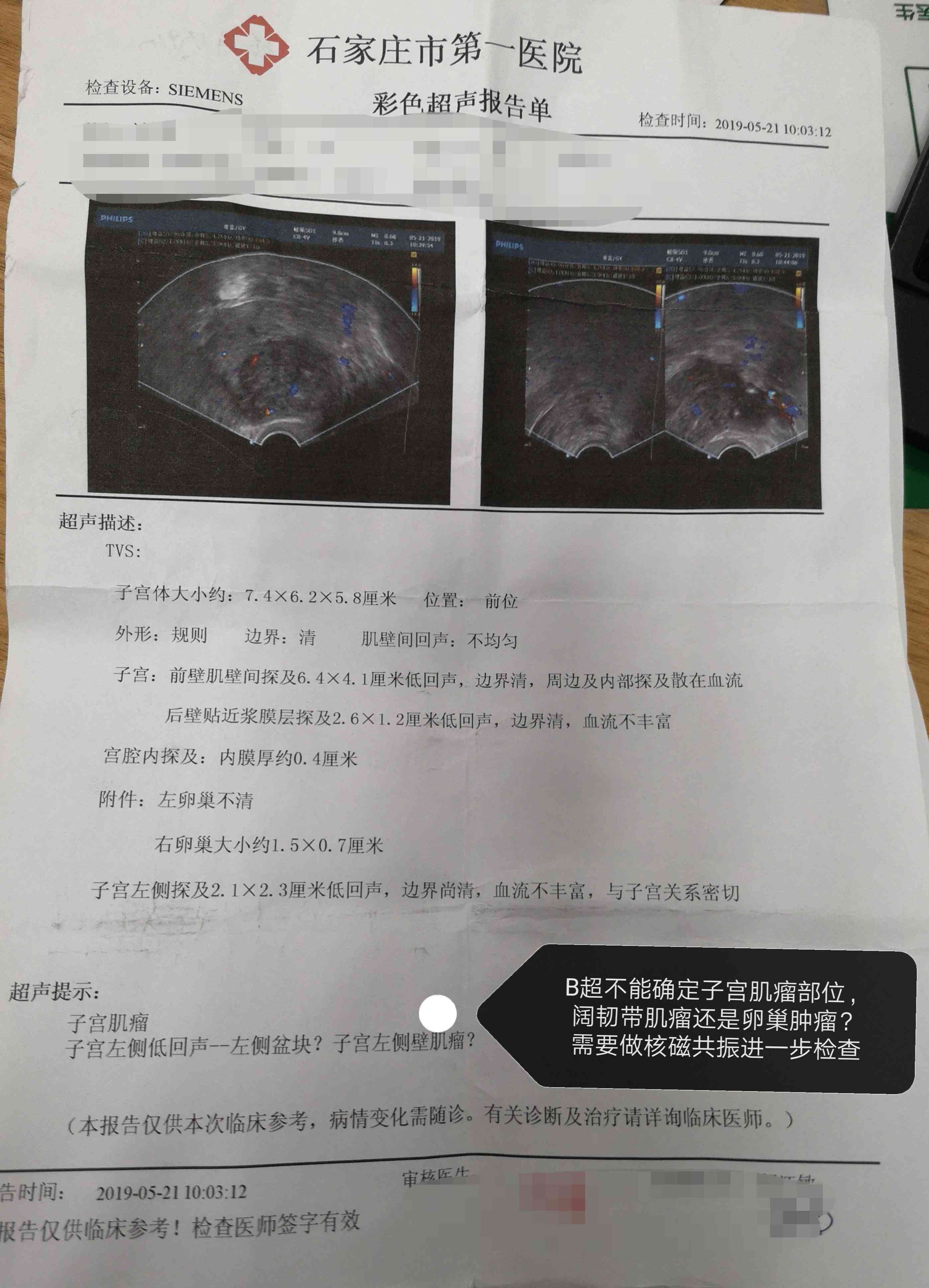 医生解读：如何详析核磁共振报告单与磁共振报告？