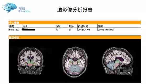 核磁共振报告单模板：详解磁共振报告的样式与结构