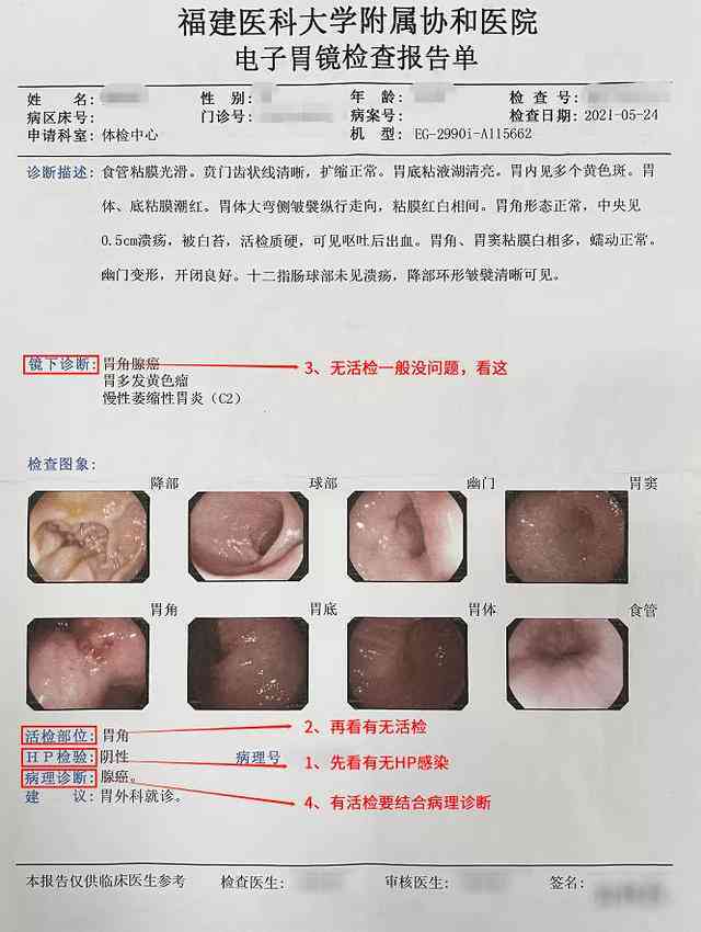 胃镜报告提示需专科检查，医生建议究竟是什么？——健网揭秘胃部健奥秘