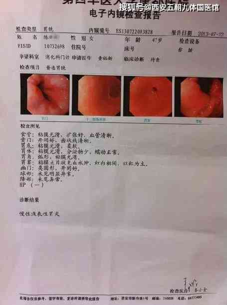 胃镜报告写着病理随访密切什么意思：详解胃镜随访与读懂病理报告的含义