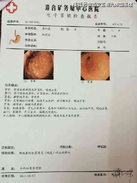 胃镜报告写着病理随访密切什么意思：详解胃镜随访与读懂病理报告的含义