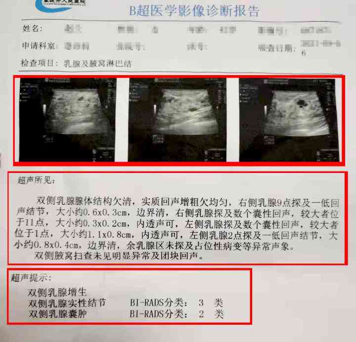 报告单解读题：怎么做、题目撰写、分析技巧、推荐与书写规范指南