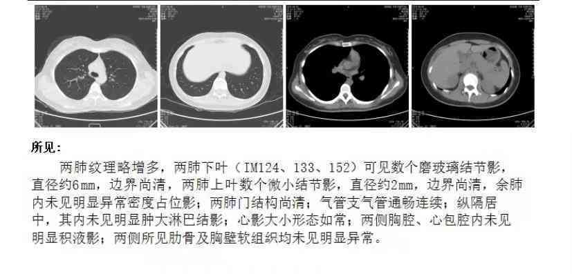 报告单解读题：怎么做、题目撰写、分析技巧、推荐与书写规范指南