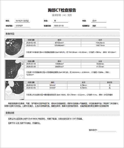 ct报告上ai是