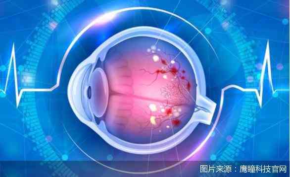 体检报告ai是什么病