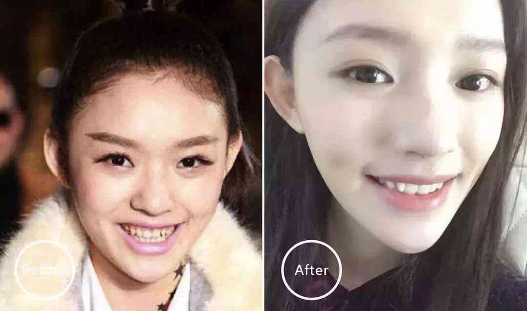 如何实现小红书无忧美妆文案生成方法：怎么做才能轻松生成优质文案？