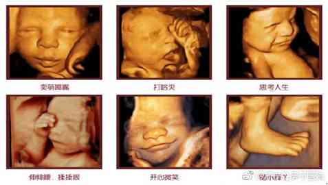 新生儿四维彩超AI照片解读指南：全面解析宝宝生长发育关键信息