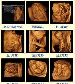 宝宝四维ai照片文案