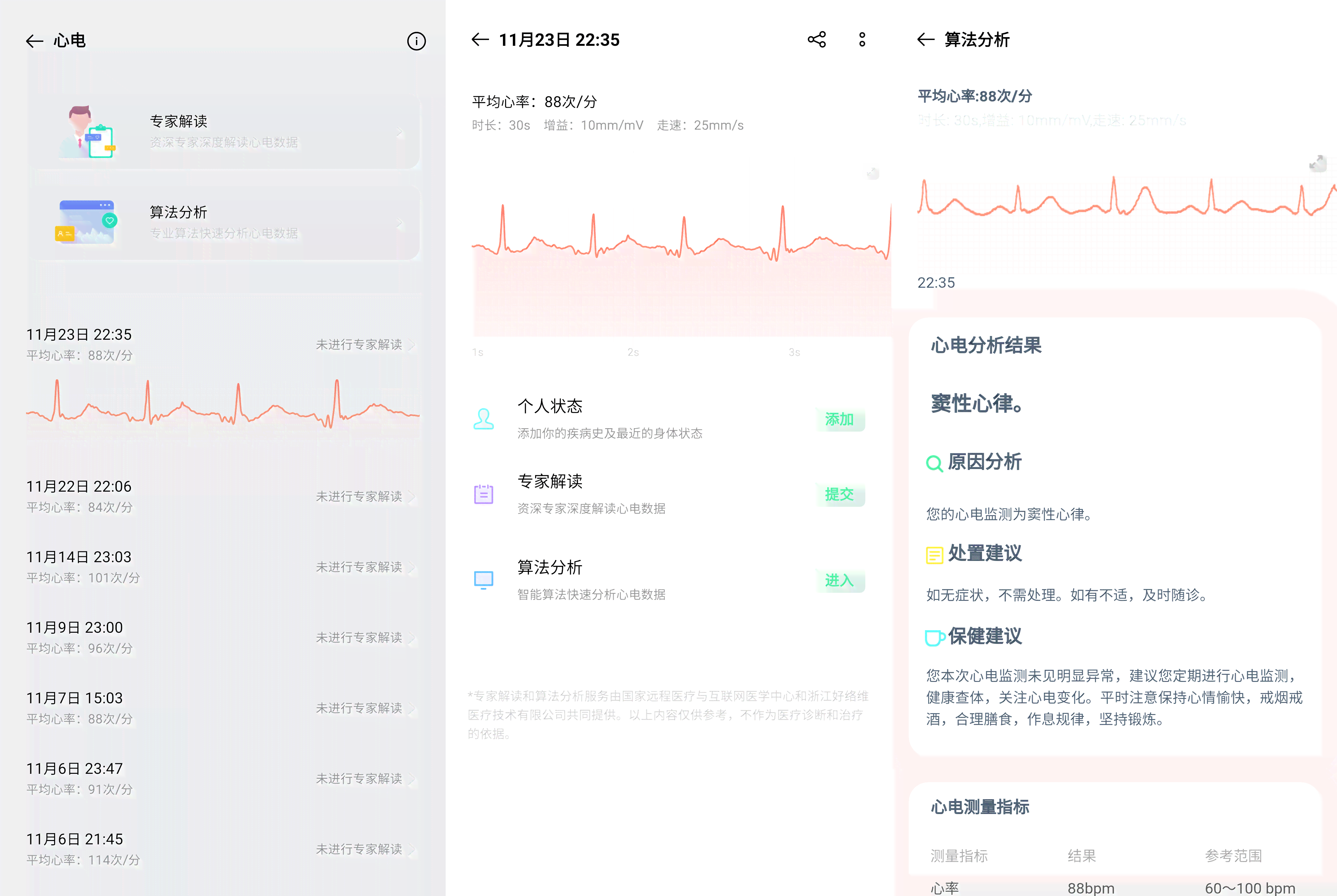 智能体检报告解读助手：一键轻松洞察健信息