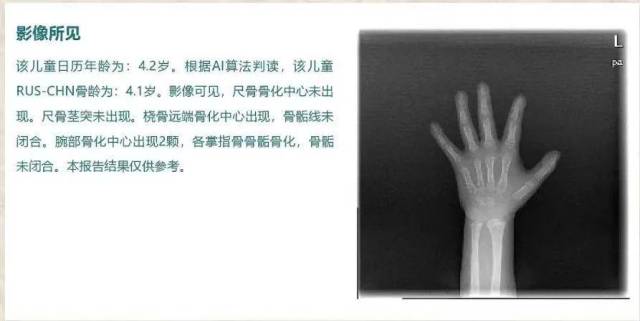 ai骨龄检测评估报告怎么看：解读结果与评价报告单详解