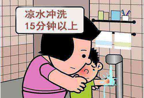 长时间烫伤工伤认定：一年多烫伤能否被判定为工伤？