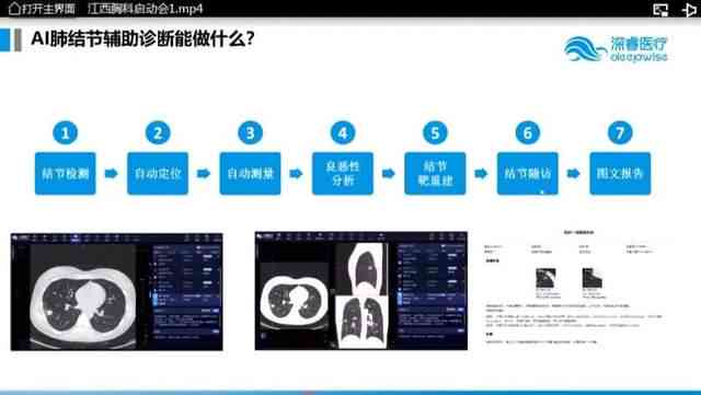 AI技术革新医疗诊断：自动生成详尽放射科报告，助力精准医疗决策