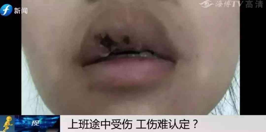 工伤认定的标准与界定：详解不同程度受伤的工伤判定条件