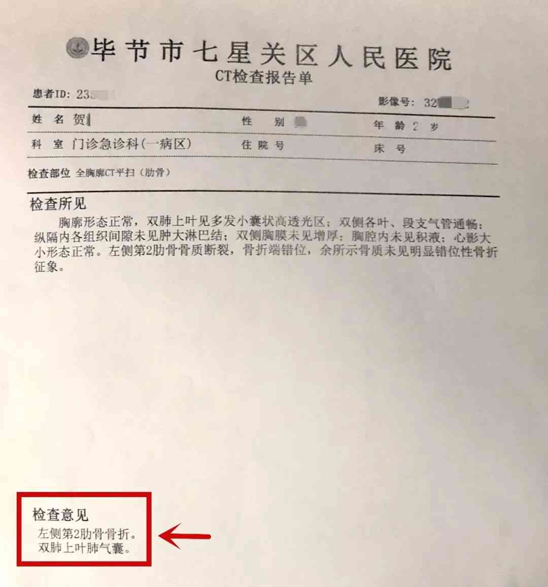 全面解析：三根肋骨骨折工伤全赔偿项目及标准一览
