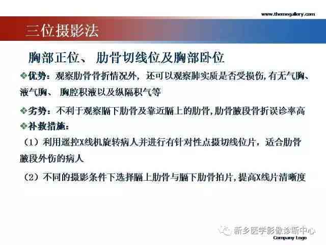 三根肋骨骨折工伤等级判定及赔偿标准详解