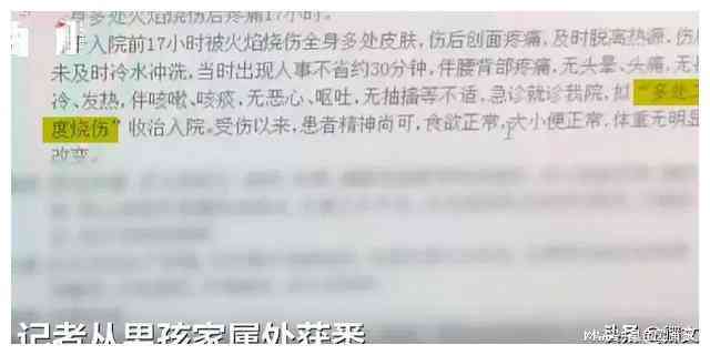 三根肋骨骨折鉴定：工伤等级划分解析