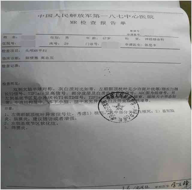 上班期间突发脑淤血算不算工伤：涉及事故认定、单位责任及工伤待遇问题