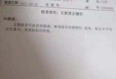 轻微工伤未伤及骨头，如何准确鉴定工伤等级及赔偿标准