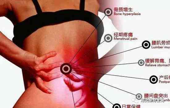腰椎损伤不包括在工伤认定的七种典型情形中
