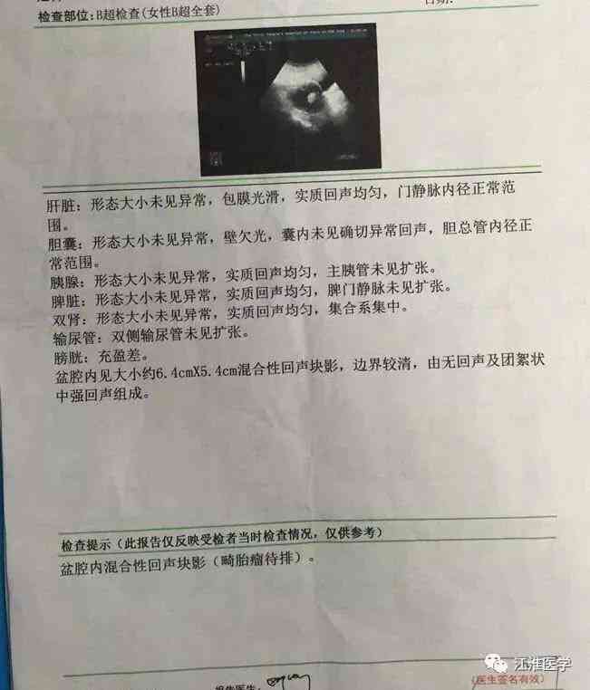 两次工伤鉴定结果不一样,怎样赔偿——处理结果差异及多次鉴定规定