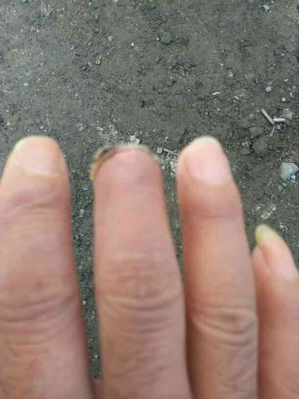 中指失去功能认定工伤几级