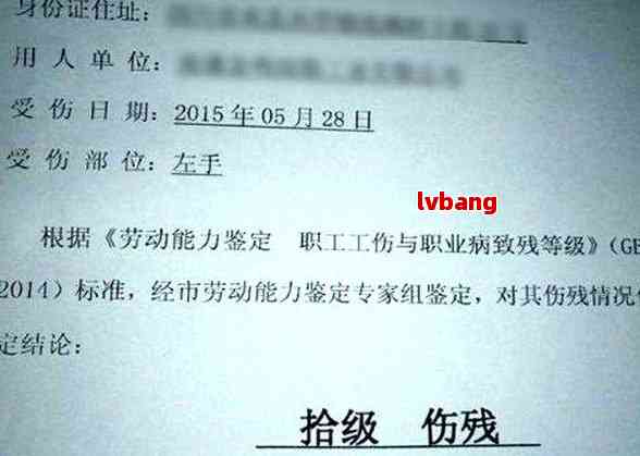 临床诊断能认定工伤吗