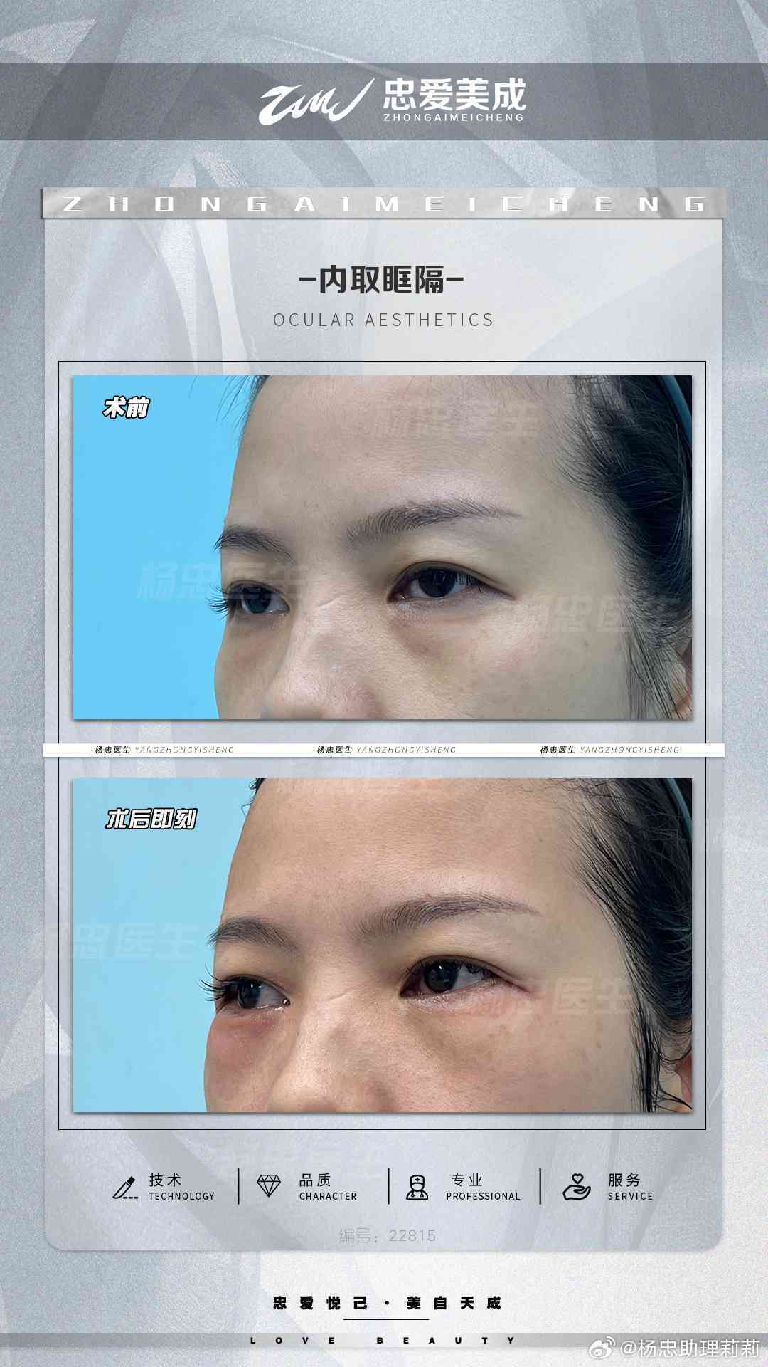 AI眼袋对比神器：全面解析效果差异，教你撰写吸引眼球的对比文案秘