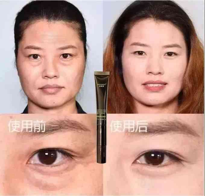 全方位眼袋改善效果对比：告别眼袋，见证肌肤焕新之旅