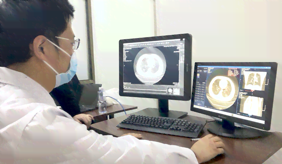 人工智能辅助诊断：医院CT报告揭示AI精准分析结果