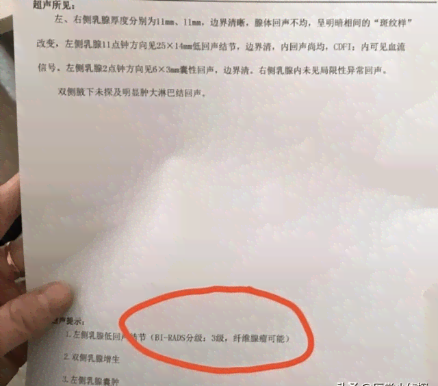 乳腺结节职业相关性探讨：能否认定为工伤及其赔偿标准解析