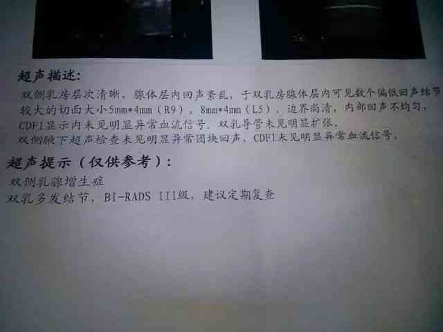 乳腺结节职业相关性探讨：能否认定为工伤及其赔偿标准解析