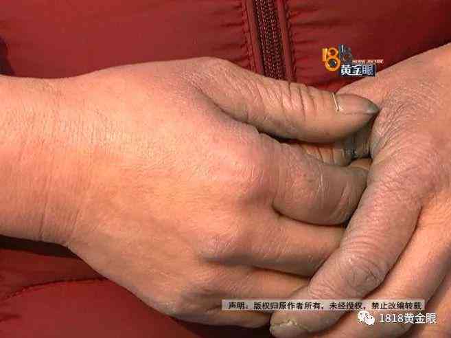 事业单位工伤认定及赔偿全攻略：详解补偿项目、标准与流程
