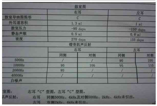 听力测试ai68是什么意思及正常值标准（ai, ac, bc）