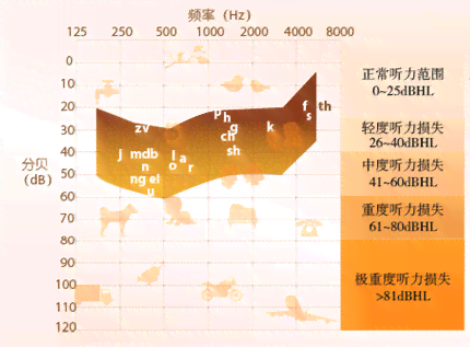 听力测试ai68是什么意思及正常值标准（ai, ac, bc）