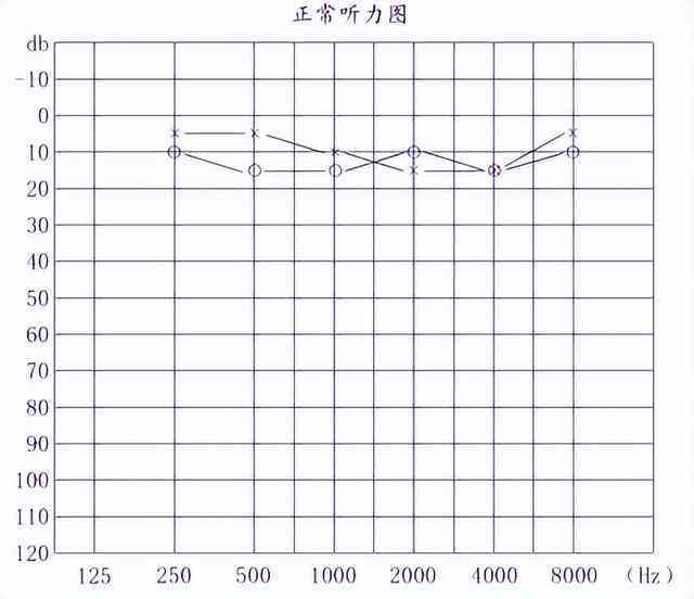 听力测试ai68是什么意思及正常值标准（ai, ac, bc）