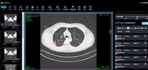 人工智能cta检查主要针对什么器官：深入解析应用范围