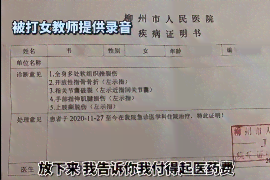 工伤食指损伤等级认定标准及条件》