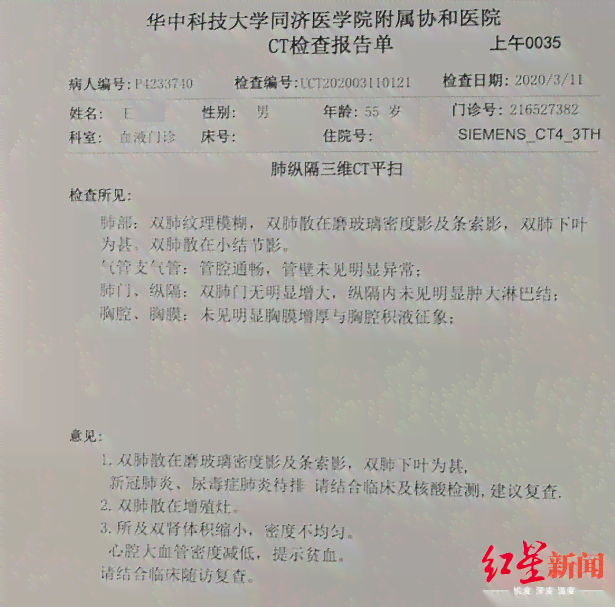 '工伤体检已完成，待结果揭晓——体检报告何时揭晓？'