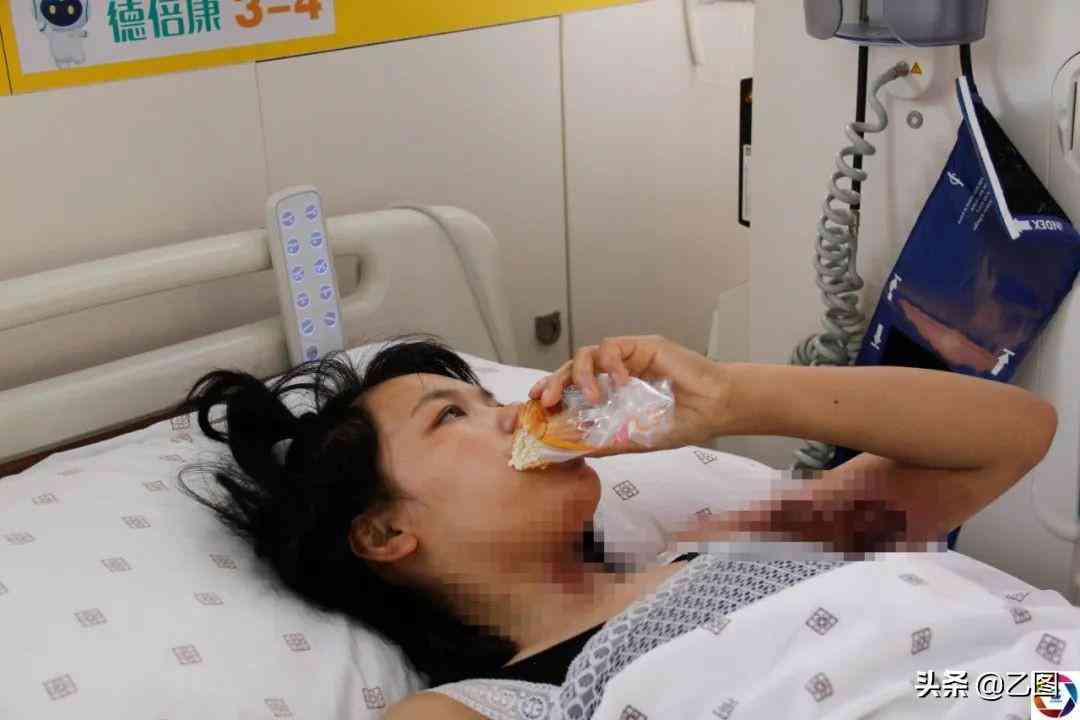 做饭烫伤会不会留疤以及如何去除疤痕？