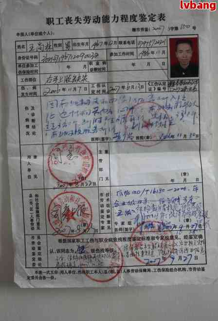 '停工留薪期间未进行伤残鉴定如何处理'