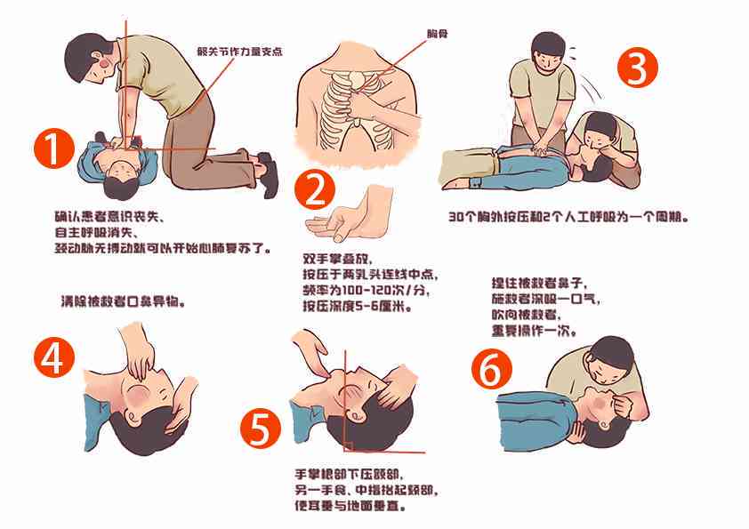 突发吸停止急救指南：如何快速应对与挽救生命