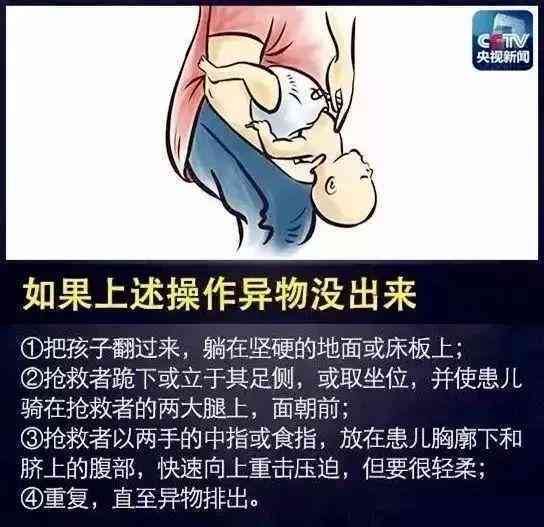 突发吸停止急救指南：如何快速应对与挽救生命