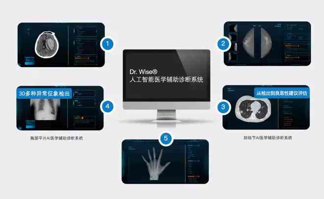 全方位解析：AI医学影像诊断技术的应用与前沿发展