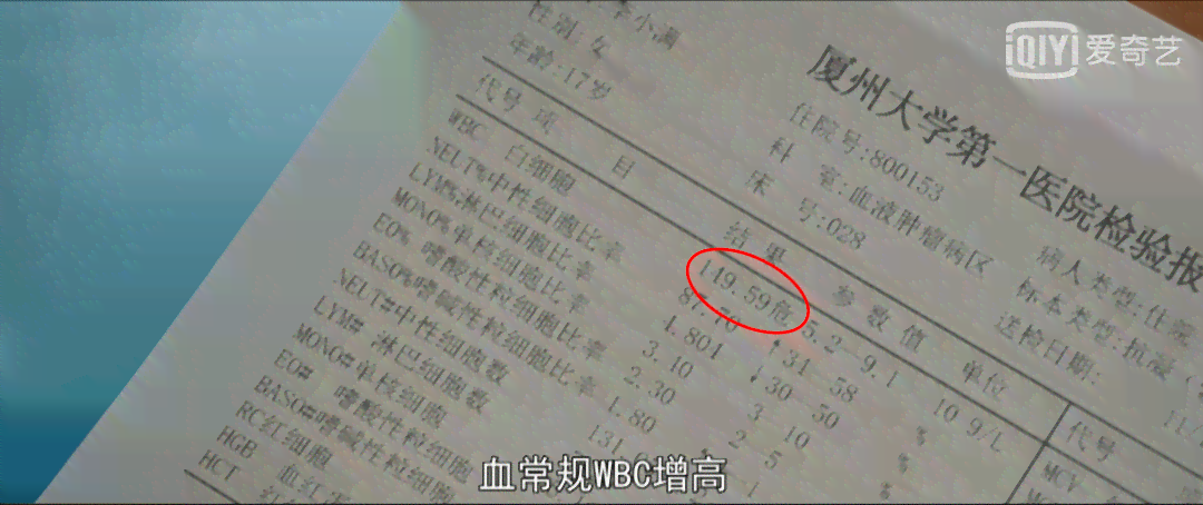 冻伤能否被认定为职业病：全面解析冻伤的职业病认定标准与条件