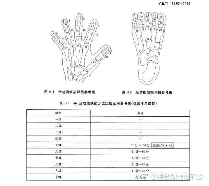 创伤性关节炎伤残等级：鉴定标准、评定与划分指南
