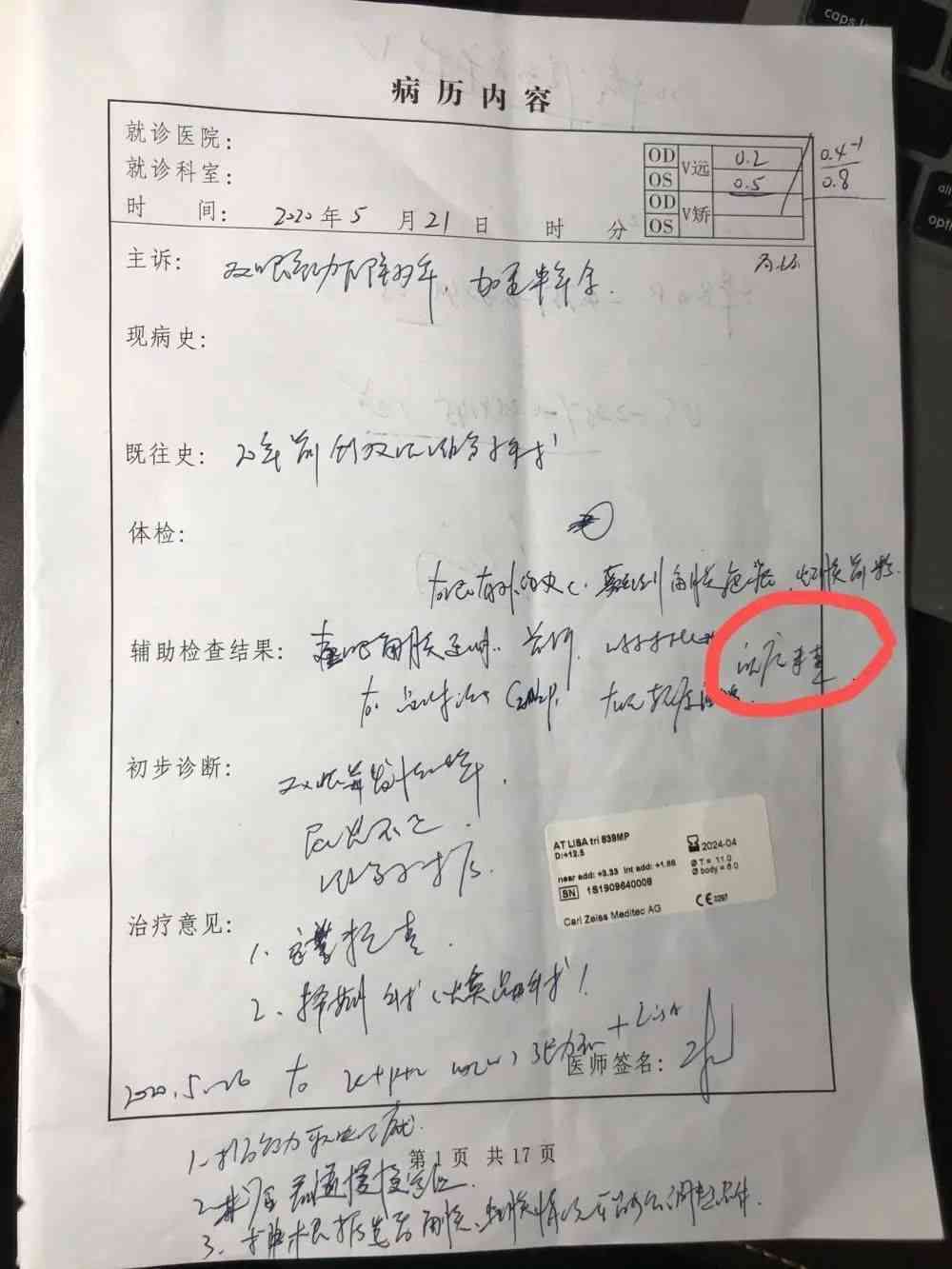 创伤性关节炎的伤残评级标准与认定流程详解