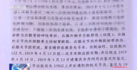 创伤性关节炎的伤残评级标准与认定流程详解