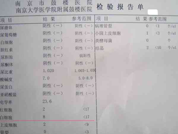 创伤性关节炎可以评几级伤残鉴定：关节炎伤残等级与级别判定详解